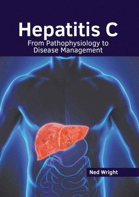 Hepatitis C: From Pathophysiology to Disease Management