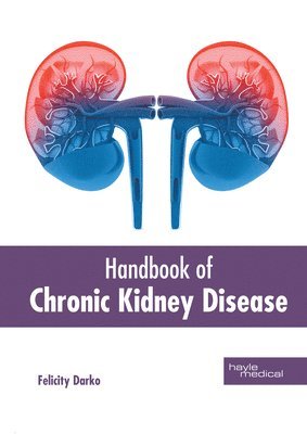 Felicity Darko - Handbook of Chronic Kidney Disease, Inbunden. Tillgänglighet: Lägg i varukorg