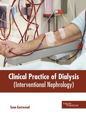 Sean Eastwood - Clinical Practice of Dialysis (Interventional Nephrology), Inbunden. Tillgänglighet: Lägg i varukorg