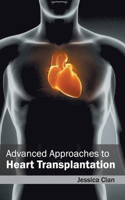 Jessica Clan - Advanced Approaches to Heart Transplantation, Inbunden