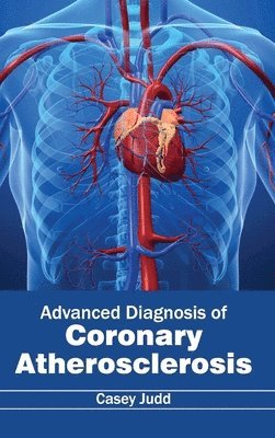 Casey Judd - Advanced Diagnosis of Coronary Atherosclerosis, Inbunden. Tillgänglighet: Lägg i varukorg
