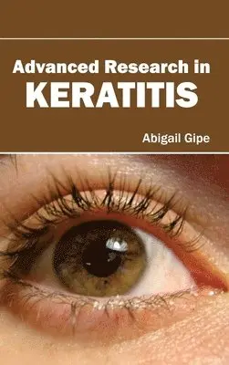 Abigail Gipe - Advanced Research in Keratitis, Inbunden. Tillgänglighet: Lägg i varukorg