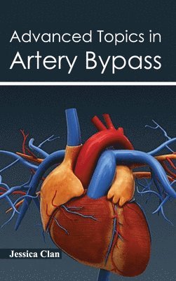 Jessica Clan - Advanced Topics in Artery Bypass, Inbunden