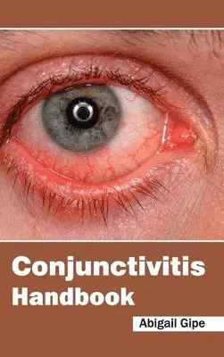Abigail Gipe - Conjunctivitis Handbook, Inbunden. Tillgänglighet: Lägg i varukorg
