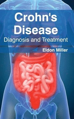 Eldon Miller - Crohn's Disease: Diagnosis and Treatment, Inbunden