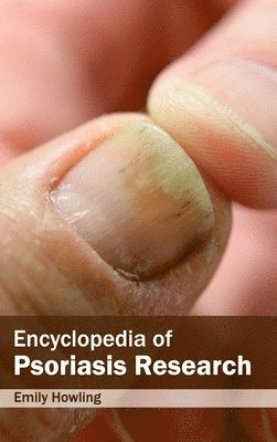 Emily Howling - Encyclopedia of Psoriasis Research, Inbunden. Tillgänglighet: Lägg i varukorg