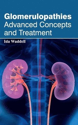 Ida Waddell - Glomerulopathies: Advanced Concepts and Treatment, Inbunden. Tillgänglighet: Lägg i varukorg