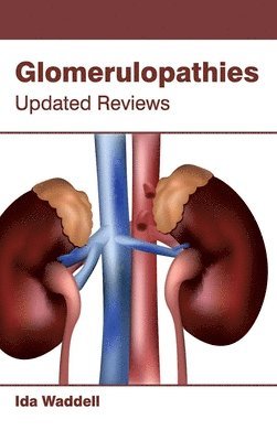 Ida Waddell - Glomerulopathies: Updated Reviews, Inbunden. Tillgänglighet: Lägg i varukorg