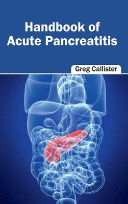 Greg Callister - Handbook of Acute Pancreatitis, Inbunden