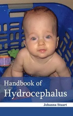 Johanna Stuart - Handbook of Hydrocephalus, Inbunden. Tillgänglighet: Lägg i varukorg