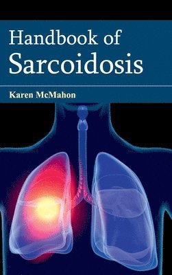 Karen McMahon - Handbook of Sarcoidosis, Inbunden. Tillgänglighet: Lägg i varukorg