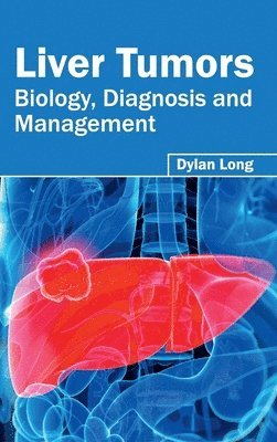Dylan Long - Liver Tumors: Biology, Diagnosis and Management, Inbunden. Tillgänglighet: Lägg i varukorg