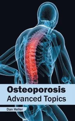 Dan Heller - Osteoporosis: Advanced Topics, Inbunden. Tillgänglighet: Lägg i varukorg
