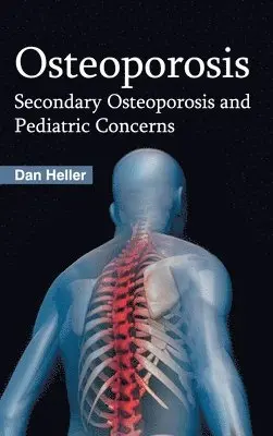 Dan Heller - Osteoporosis: Secondary Osteoporosis and Pediatric Concerns, Inbunden. Tillgänglighet: Lägg i varukorg