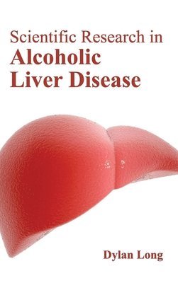 Dylan Long - Scientific Research in Alcoholic Liver Disease, Inbunden. Tillgänglighet: Lägg i varukorg