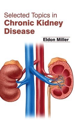 Eldon Miller - Selected Topics in Chronic Kidney Disease, Inbunden