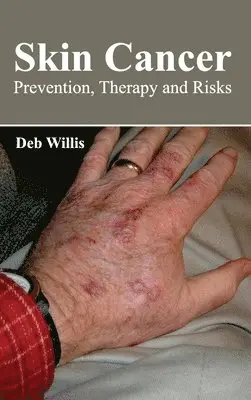 Deb Willis - Skin Cancer: Prevention, Therapy and Risks, Inbunden. Tillgänglighet: Lägg i varukorg