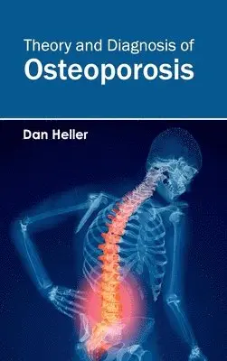 Dan Heller - Theory and Diagnosis of Osteoporosis, Inbunden. Tillgänglighet: Lägg i varukorg