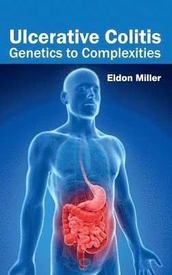 Eldon Miller - Ulcerative Colitis: Genetics to Complexities, Inbunden