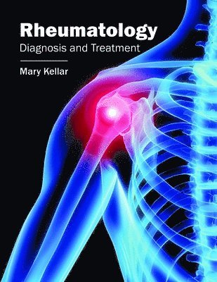 Mary Kellar - Rheumatology: Diagnosis and Treatment, Inbunden. Tillgänglighet: Lägg i varukorg