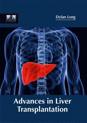 Dylan Long - Advances in Liver Transplantation, Inbunden. Tillgänglighet: Lägg i varukorg