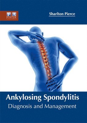 Sharlton Pierce - Ankylosing Spondylitis: Diagnosis and Management, Inbunden. Tillgänglighet: Lägg i varukorg