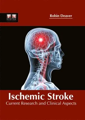 Robin Deaver - Ischemic Stroke: Current Research and Clinical Aspects, Inbunden. Tillgänglighet: Lägg i varukorg