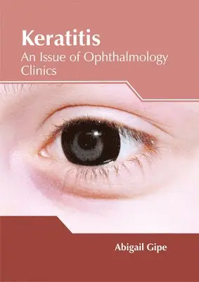 Abigail Gipe - Keratitis: An Issue of Ophthalmology Clinics, Inbunden. Tillgänglighet: Lägg i varukorg
