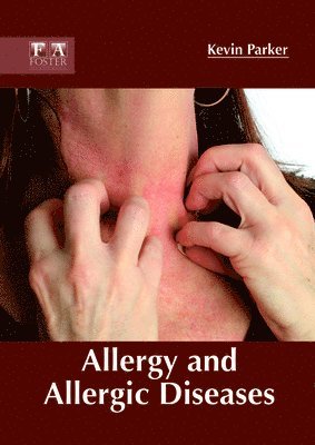 Kevin Parker - Allergy and Allergic Diseases, Inbunden