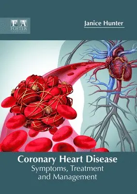 Janice Hunter - Coronary Heart Disease: Symptoms, Treatment and Management, Inbunden. Tillgänglighet: Lägg i varukorg