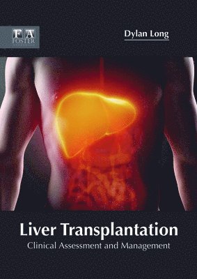 Dylan Long - Liver Transplantation: Clinical Assessment and Management, Inbunden. Tillgänglighet: Lägg i varukorg