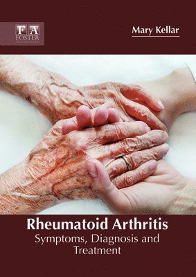 Mary Kellar - Rheumatoid Arthritis: Symptoms, Diagnosis and Treatment, Inbunden. Tillgänglighet: Lägg i varukorg