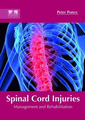Spinal Cord Injuries: Management and Rehabilitation av Peter Ponce