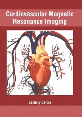 Zachary Garcia - Cardiovascular Magnetic Resonance Imaging, Inbunden. Tillgänglighet: Lägg i varukorg