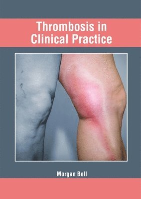 Morgan Bell - Thrombosis in Clinical Practice, Inbunden. Tillgänglighet: Lägg i varukorg