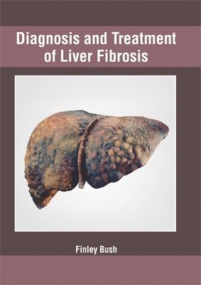 Finley Bush - Diagnosis and Treatment of Liver Fibrosis, Inbunden. Tillgänglighet: Lägg i varukorg