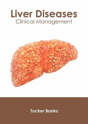 Liver Diseases: Clinical Management