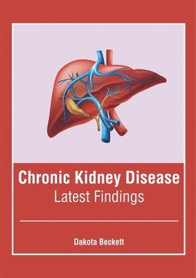 Dakota Beckett - Chronic Kidney Disease: Latest Findings, Inbunden. Tillgänglighet: Lägg i varukorg