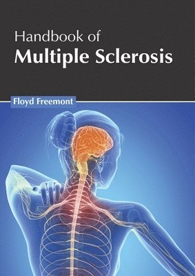 Floyd Freemont - Handbook of Multiple Sclerosis, Inbunden