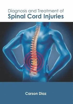 Carson Diaz - Diagnosis and Treatment of Spinal Cord Injuries, Inbunden. Tillgänglighet: Lägg i varukorg