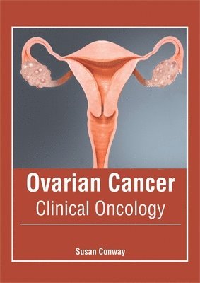 Susan Conway - Ovarian Cancer: Clinical Oncology, Inbunden