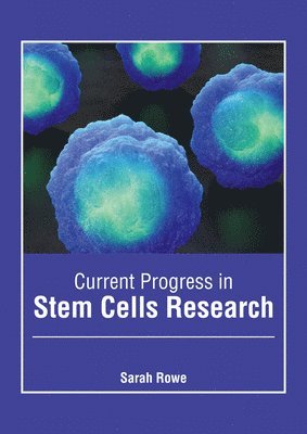 Sarah Rowe - Current Progress in Stem Cells Research, Inbunden. Tillgänglighet: Lägg i varukorg