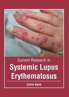 Carrie Kane - Current Research in Systemic Lupus Erythematosus, Inbunden. Tillgänglighet: Lägg i varukorg