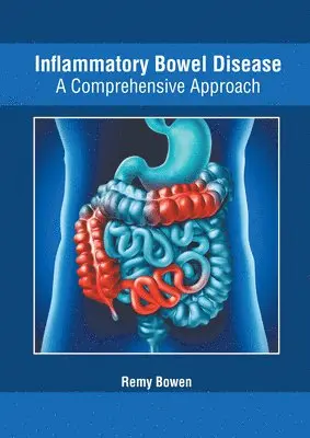 Remy Bowen - Inflammatory Bowel Disease: A Comprehensive Approach, Inbunden. Tillgänglighet: Lägg i varukorg