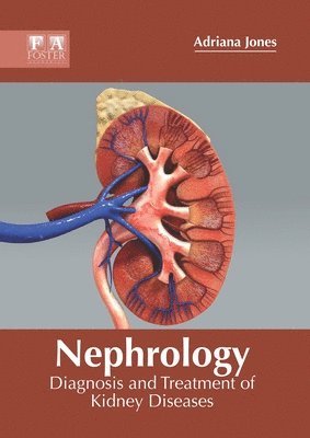Adriana Jones - Nephrology: Diagnosis and Treatment of Kidney Diseases, Inbunden. Tillgänglighet: Lägg i varukorg