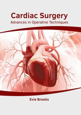 Evie Brooks - Cardiac Surgery: Advances in Operative Techniques, Inbunden