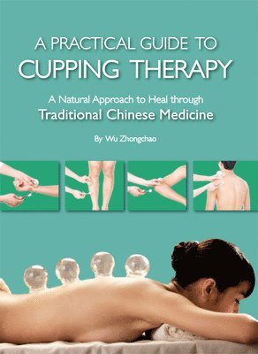 Zhongchao Wu - Practical Guide to Cupping Therapy: A Natural Approach to Heal Through Traditional Chinese Medicine, Häftad