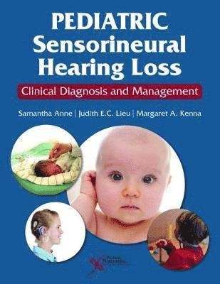 TBD, Samantha Anne, Judith E. C. Lieu, Margaret A. Kenna - Pediatric Sensorineural Hearing Loss, Häftad. Tillgänglighet: Tillfälligt slut