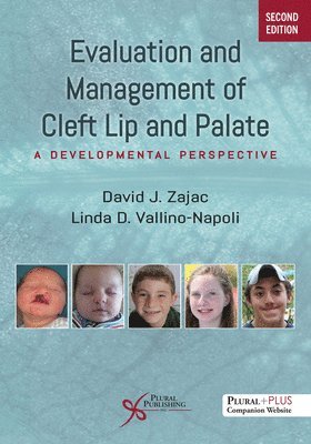 David J. Zajac, Linda D. Vallino-Napoli - Evaluation and Management of Cleft Lip and Palate, Häftad