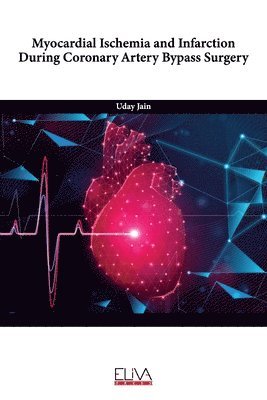 Uday Jain - Myocardial Ischemia and Infarction During Coronary Artery Bypass Surgery, Häftad